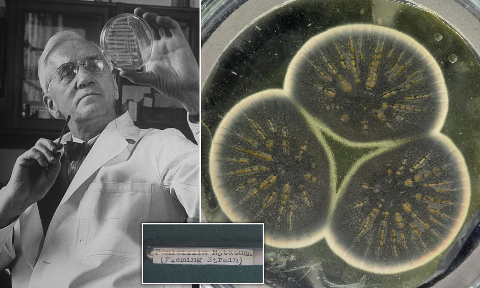 Alexander Fleming Kimdir? Antibiyotiğin Keşfi!